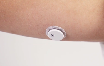 bloog glucose sensor
